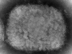 This 2003 electron microscope image made available by the Centers for Disease Control and Prevention shows a monkeypox virion, obtained from a sample associated with the 2003 prairie dog outbreak. Monkeypox, a disease that rarely appears outside Africa, has been identified by European and American health authorities in recent days.