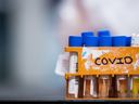 Proben, die auf COVID-19 getestet werden sollen, werden am 26. März 2020 in einem Labor in Surrey, BC, gesehen.