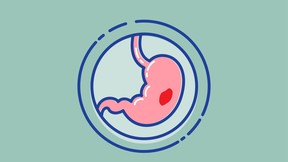 Stomach problem icon. Stomach ulcer. Linear icons in a circle.