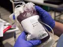 A bag of blood is shown at a clinic in Montreal, Thursday, Nov. 29, 2012. Tougher iron guidelines for blood donors will almost certainly reduce collections in the short term, a spokesperson for Canadian Blood Services said as the national agency appealed for more donations. did.  .