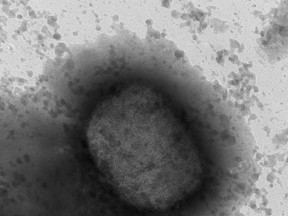 An electronic microscope image shows the monkeypox virus seen by a team from the Arbovirus Laboratory and the Genomics and Bioinformatics Units of the Carlos III Health Institute (ISCIII) in Madrid, Thursday May 26, 2022. The Public Health Agency of Canada is warning travellers to be extra careful abroad because of the potential threat of catching monkeypox. THE CANADIAN PRESS/Unidad de Microscopi­a Electronica del ISCIII, via AP