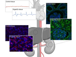 Zeichnung, die den Unterschied zwischen Schweinen zeigt, die auf das OrganEx-System gesetzt wurden, und denen, die auf ECMO gesetzt wurden.