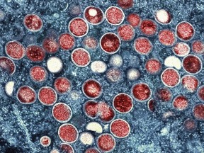 FILE - This image provided by the National Institute of Allergy and Infectious Diseases (NIAID) shows a colorized transmission electron micrograph of monkeypox particles (red) found within an infected cell (blue), cultured in the laboratory that was captured and color-enhanced at the NIAID Integrated Research Facility (IRF) in Fort Detrick, Md. The official IRNA news agency reported announced Tuesday, Aug. 16, 2022, the first case of monkeypox in the nation. The report said health authorities quarantined a 34-year-old woman living in the southwestern city of Ahvaz. (NIAID via AP, File)