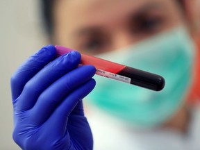 A laboratory technician wearing surgical gloves holds a patient's blood sample.