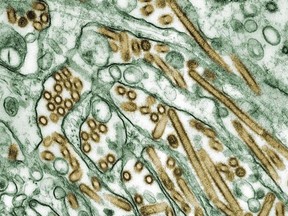 Colorized transmission electron micrograph of Avian influenza A H5N1 viruses (seen in gold) grown in MDCK cells (seen in green) as shown in this undated handout photo. The Northwest Territories has confirmed its first case of avian influenza in a wild bird found in Yellowknife.