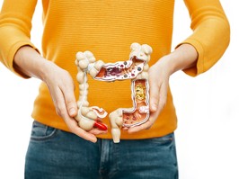 Treatment of crohns disease, flatulence, indigestion. Woman holds in front of her anatomical model of the colon, she has constipation and abdominal pain