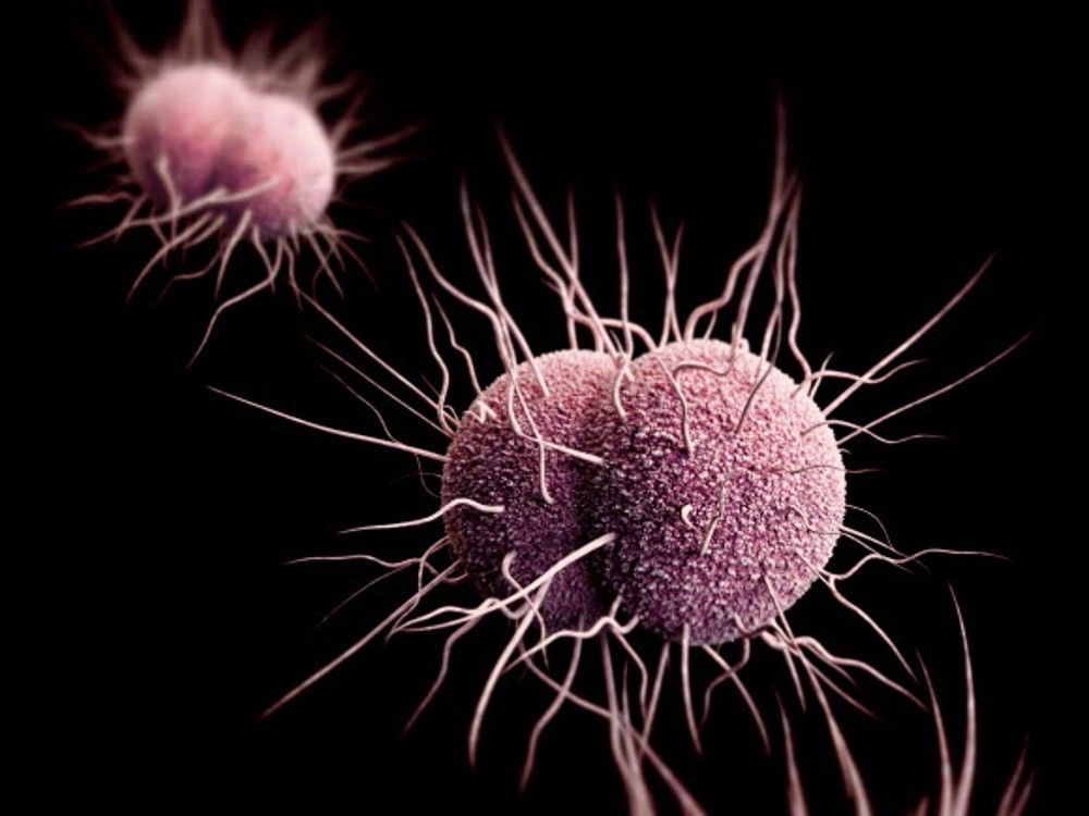 There’s a ‘concerning’ new strain of gonorrhea with resistance to antibiotics