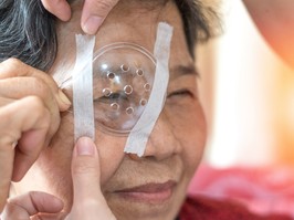 'The most successful procedure in all of medicine': Cataract surgery can give the gift of sight