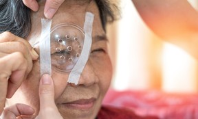 'The most successful procedure in all of medicine': Cataract surgery can give the gift of sight