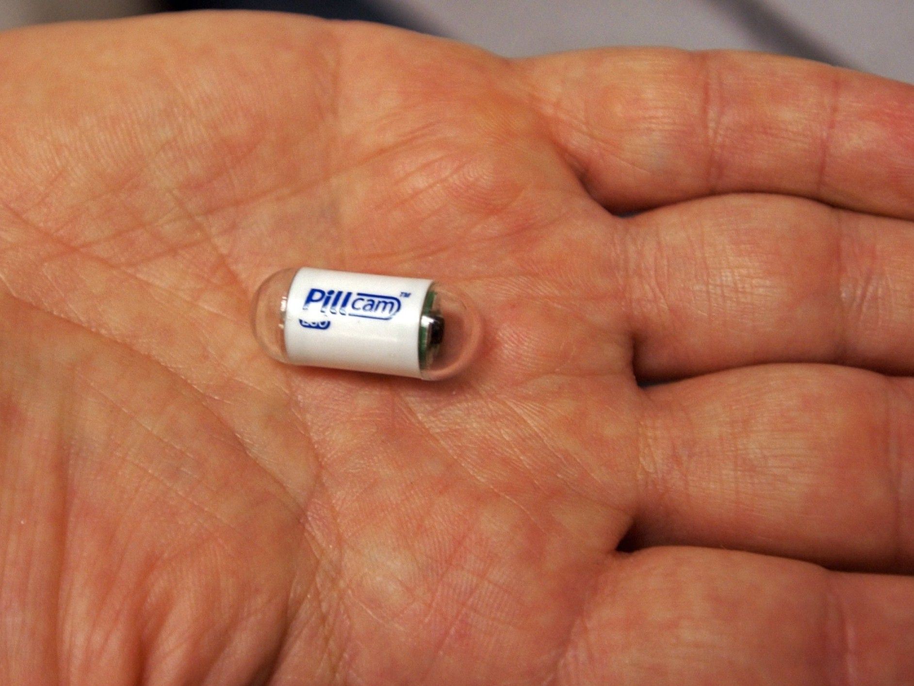 The Pillcam ESO is used to photograph a patient’s esophagus.