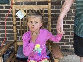 Kinsley White, 6, shows reporters a wound left on her face, Thursday, April 20, 2023 in Gastonia, N.C. A North Carolina man shot and wounded a 6-year-old girl and her parents after children went to retrieve a basketball that had rolled into his yard, according to neighbors and the girl's family -- another in a string of recent shootings sparked by seemingly trivial reasons.