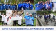 photos of scleroderma event