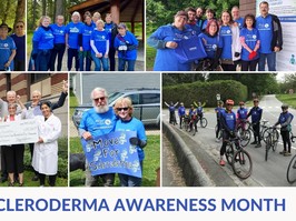 photos of scleroderma event