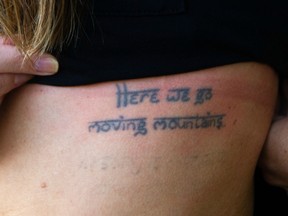 Saira Hansen shows a tattoo she is having removed.