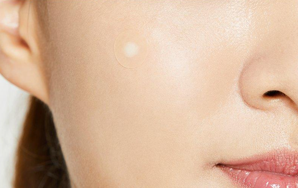 The best pimple patches in Canada 2023