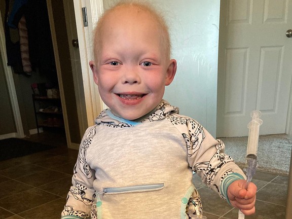 How Bella Brave became a TikTok star while waiting for transplant ... Bella Brave How Bella Brave became a TikTok star while waiting for transplant ...