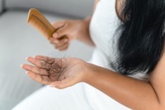Hair loss is common, but there are some treatments that actually work.