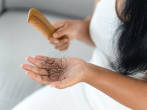Hair loss is common, but there are some treatments that actually work.