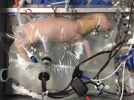 A lamb in an artificial womb