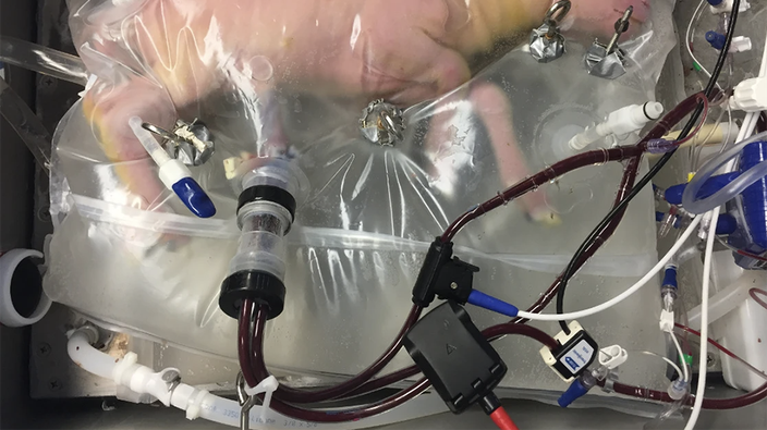 Artificial wombs are on the way. Will they change abortion rights?