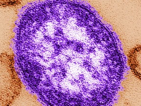 FILE - This undated image made available by the Centers for Disease Control and Prevention on Feb. 4, 2015, shows an electron microscope image of a measles virus particle, center. A West Virginia hospital has identified the first case of measles in the state since 2009, health officials said Monday, April 22, 2024.