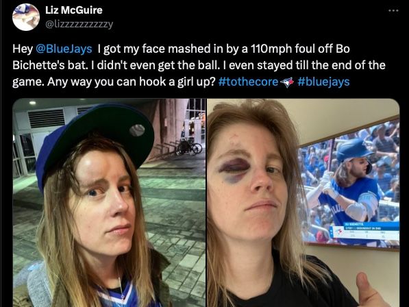 NextImg:Blue Jays fan left with painful bump, black eye by foul ball to get 110 custom baseball cards