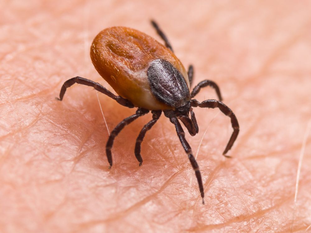 NextImg:What to know about the rise of tick-borne anaplasmosis in Canada