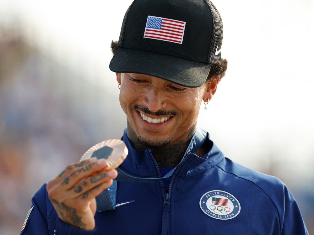 NextImg:Memories may last forever, but some 2024 Olympic medals are already looking worse for wear