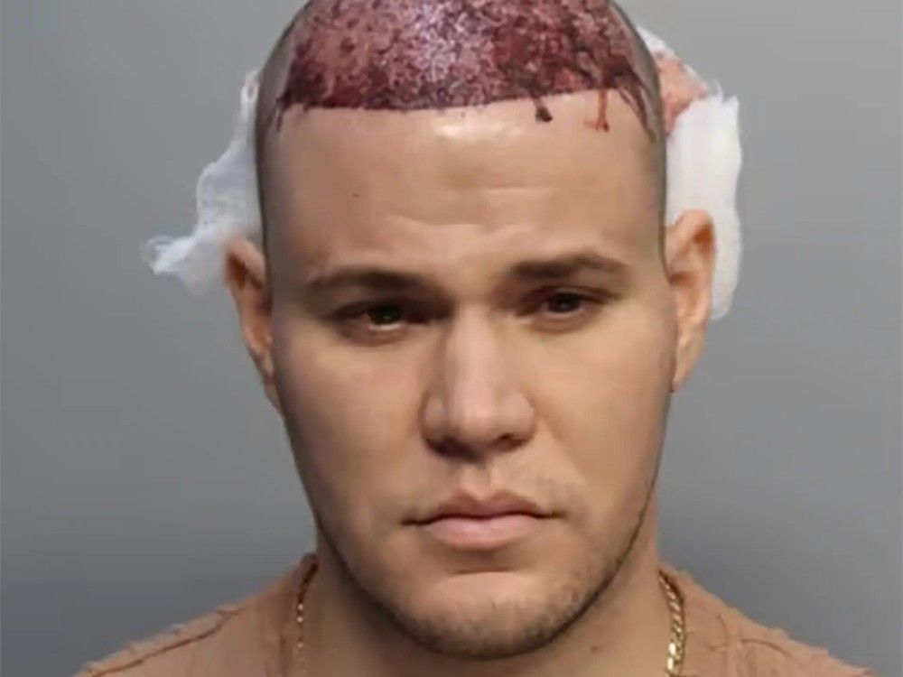 NextImg:Passenger with bloody head wound arrested after refusing to deboard American Airlines flight