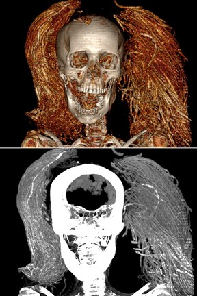 Scans of the the Screaming Woman Mummy's head.
