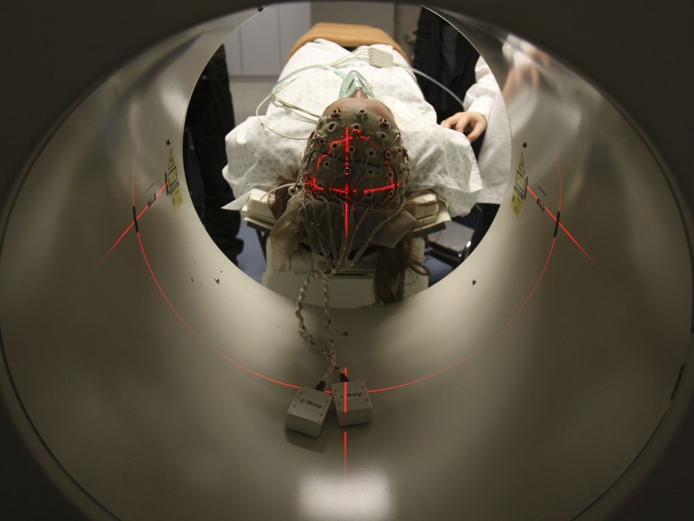 NextImg:Canadian researchers find signs of awareness in comatose patient: study