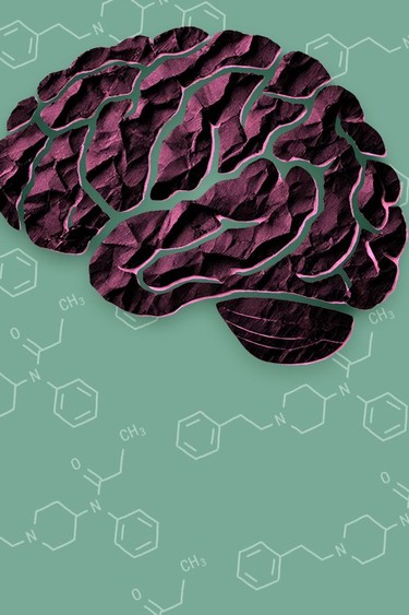 The opioid crisis has a ‘hidden’ brain injury epidemic The opioid crisis has a ‘hidden’ brain injury epidemic