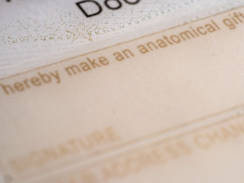 NextImg:Organ donations drop after reports of brain dead man waking up during surgery