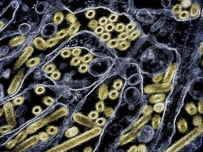 What to know about a B.C. teen in critical condition with bird flu What to know about a B.C. teen in critical condition with bird flu