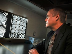 A man in a suit looks at MRI scans of a brain.