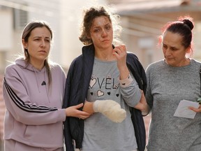 A woman with burns on her face and a bandaged hand, centre, is accompanied by two other women as they walk toward the camera