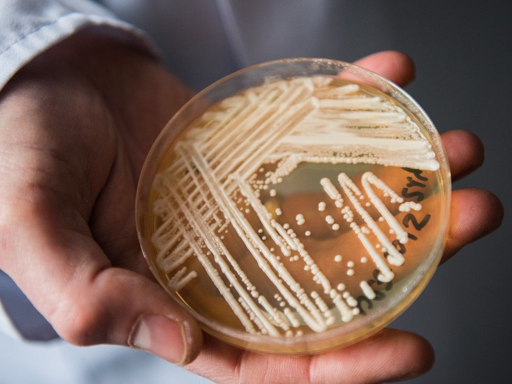 NextImg:What to know about the fatal fungus Candida auris since it was deemed an urgent threat