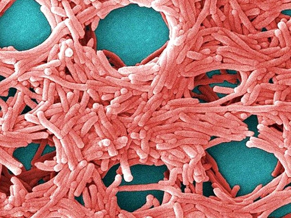 Legionnaires’ disease is a serious respiratory illness that can result in a serious chest infection or pneumonia. It is caused by a type of bacteria that lives in water called Legionella.