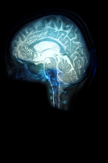 Pyschosurgery for OCD sends lobotomies back to the Dark Ages Pyschosurgery for OCD sends lobotomies back to the Dark Ages