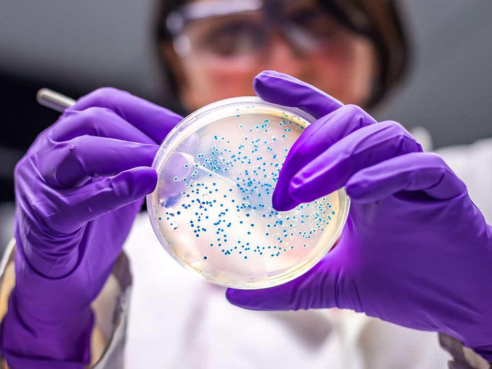 NextImg:Canada has a new list of superbugs posing greatest threat to Canadians. Here's what's on it
