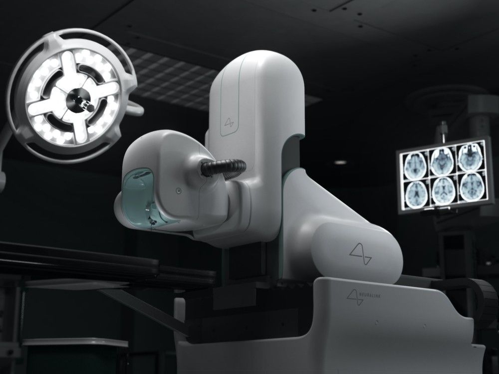 NextImg:Toronto neurosurgery team implants brain-computer devices in patients with cervical spinal cord injuries