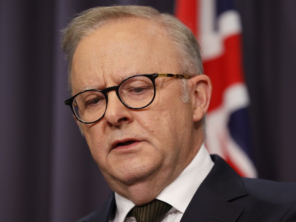  Australian Prime Minister Anthony Albanese speaks to the media at Parliament House Canberra on Sunday.