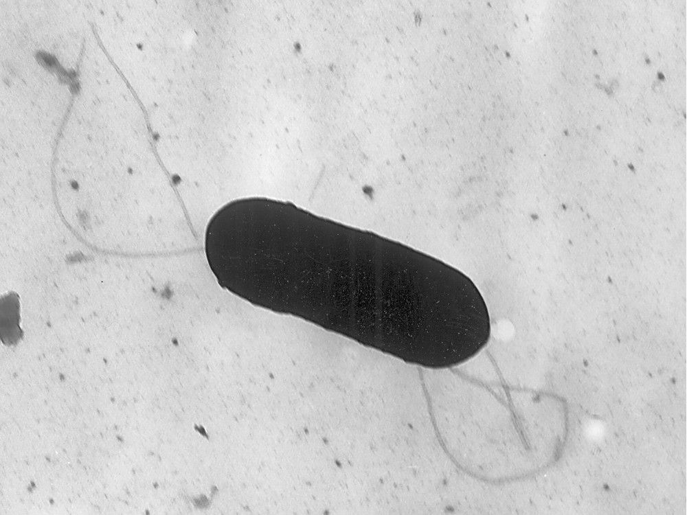  An electron microscope image made available by the Centers for Disease Control and Prevention shows a Listeria monocytogenes bacterium in a 2002 handout photo.