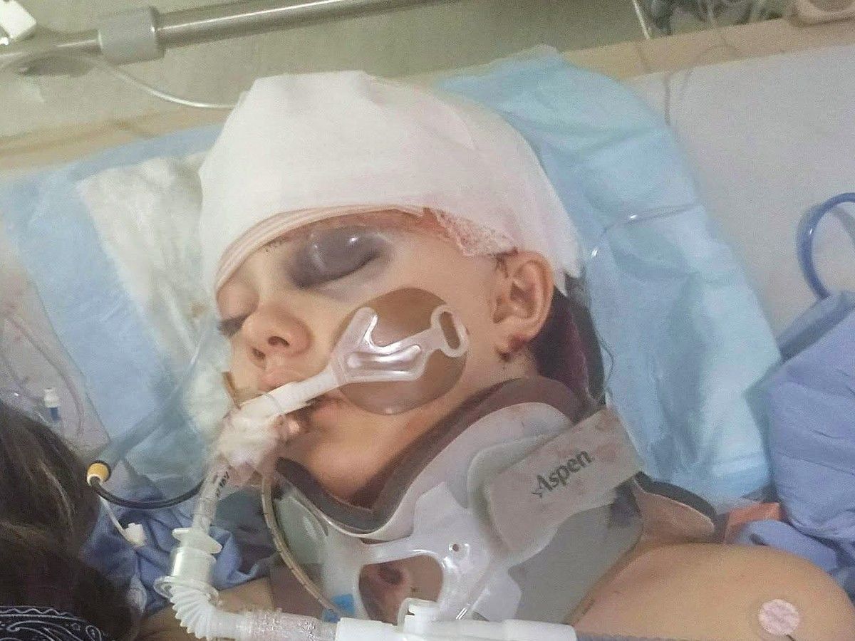 Cia Edmonds posted a photo on Facebook of her daughter 12-year old Maya Gebala in B.C. Children's Hospital in Vancouver.