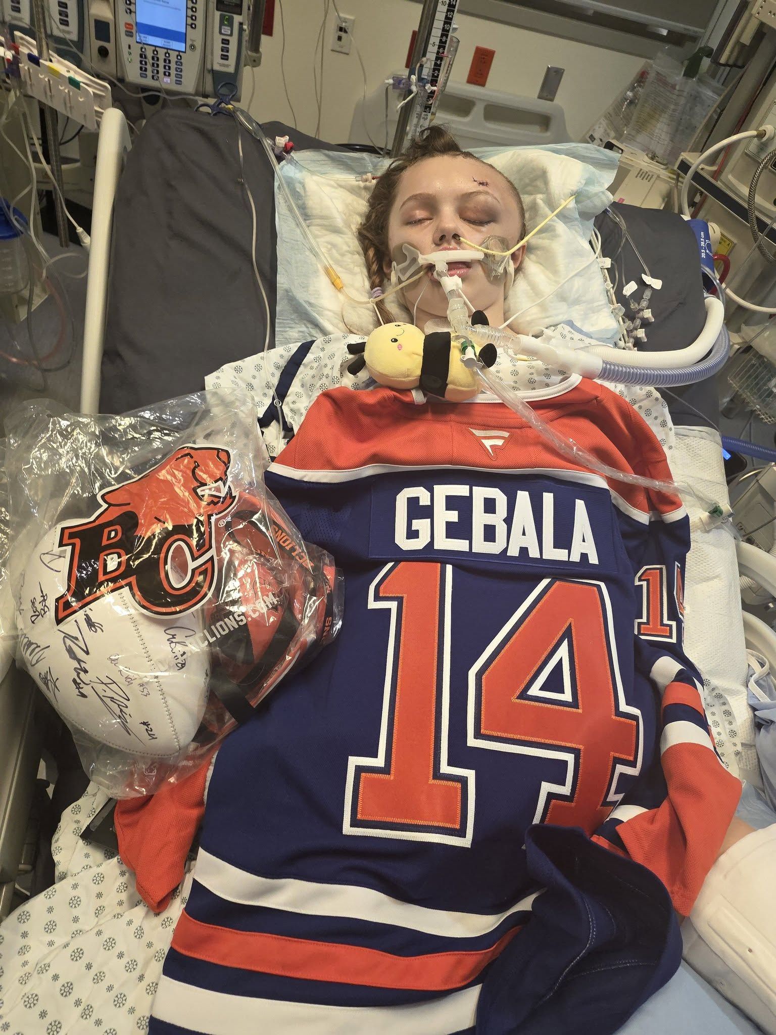  Maya Gebala in her hospital bed draped with a new jersey from the Edmonton Oilers and a signed football from the BC Lions. (Photo credit: Cia Edmonds/Facebook)