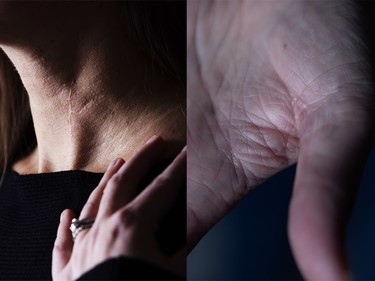 Dr. Julie Woods bears the scars of the attack on May 13, 2023: a 10-cm scar where her jugular vein was repaired, and slash marks on her hand between the thumb and index finger.