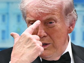 U.S. President Donald Trump gestures to his forehead as he speaks