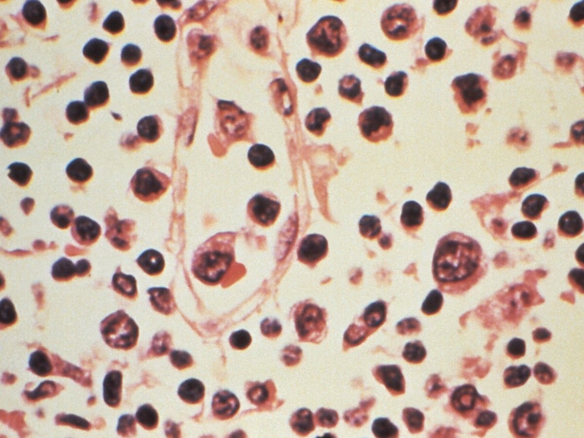 A photo of hantavirus through a microscope.