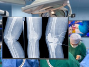 surgery
