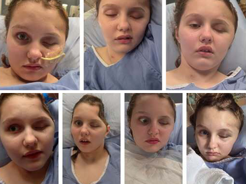 Maya Gebala’s mom shares major update: ‘If all goes great it could be her last surgery’